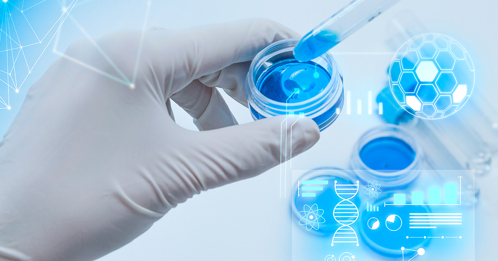 Post-Approval Change Management: Why Minor Manufacturing Site Changes Require 6-12 Months Regulatory Review